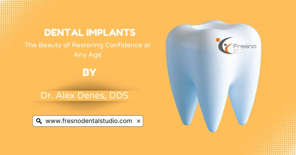Fresno dental Implants