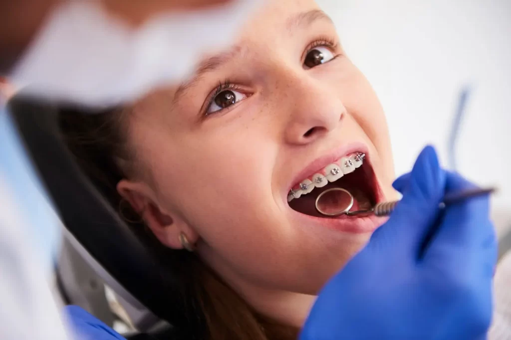 women-dental-treatment-with-dental-braces