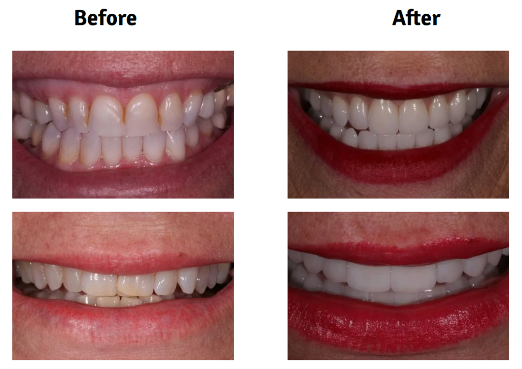 Cosmetic dentistry